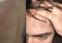 Denuncian a un entrenador de rugby por agredir a un adolescente que intentaba separar una pelea entre perros