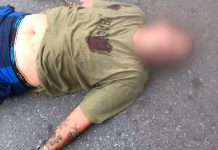 Investigan el ataque a un hombre con frondoso prontuario que fue apuñalado en La Plata