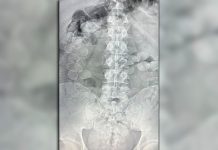 Viajaban en un micro con cápsulas de cocaína en su cuerpo y los descubrieron: los condenaron a 4 años de prisión