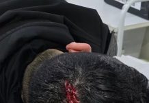 Escaparon de un control, se escondieron en una casa y agredieron a la Policía: hay tres detenidos