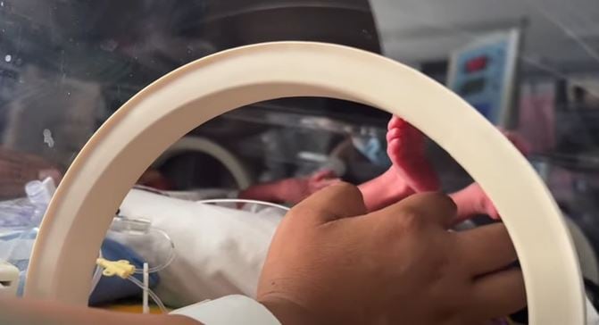 Nacieron trigemelas en Chubut, un “milagro” que ocurre una vez en millones