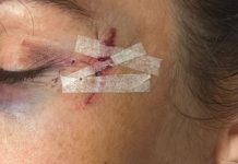 Dictaron prisión preventiva a dos mujeres acusadas de intentar matar a la hermana de un intendente de Santa Fe