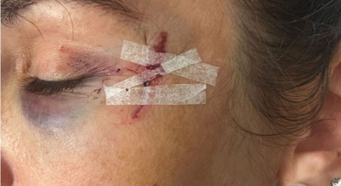 Dictaron prisión preventiva a dos mujeres acusadas de intentar matar a la hermana de un intendente de Santa Fe