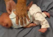 Fuerte operativo en Córdoba: armaron un cordón sanitario para salvar a una bebé de 10 días con signos de asfixia