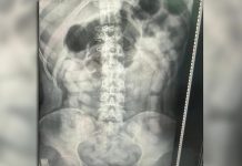 Detuvieron a seis pasajeros de un tour de compras que habían ingererido más de 500 cápsulas de cocaína