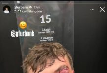 La impactante lesión de un jugador de rugby que quedó los dientes colgando: su particular reacción