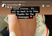 La impresionante lesión en el fútbol europeo que abrió el debate sobre el uso de las canilleras