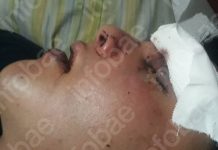 “Se ahogaba con su sangre”, el crudo relato de la novia del joven que denunció una agresión en un boliche de San Telmo